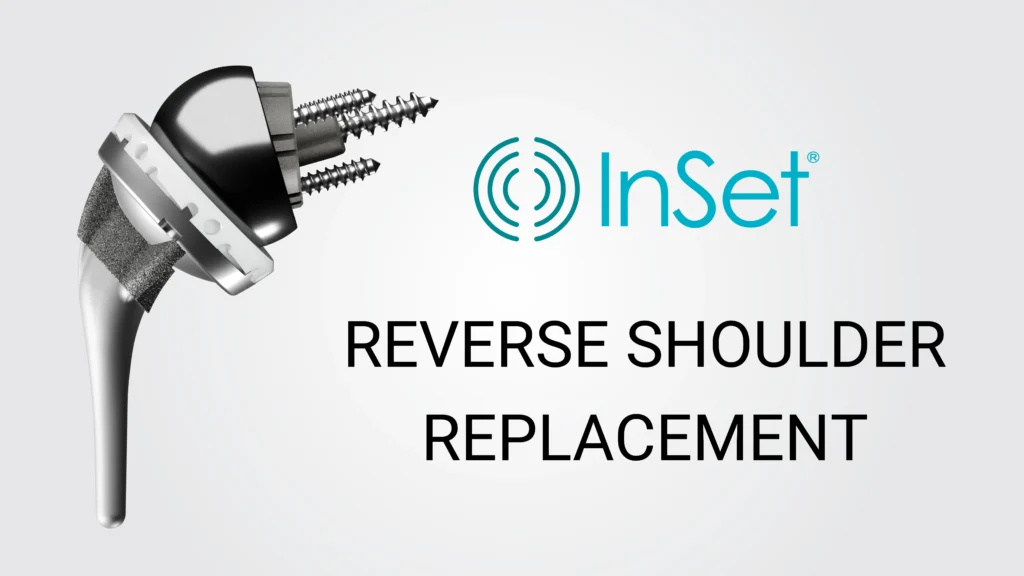Reverse Shoulder Replacement