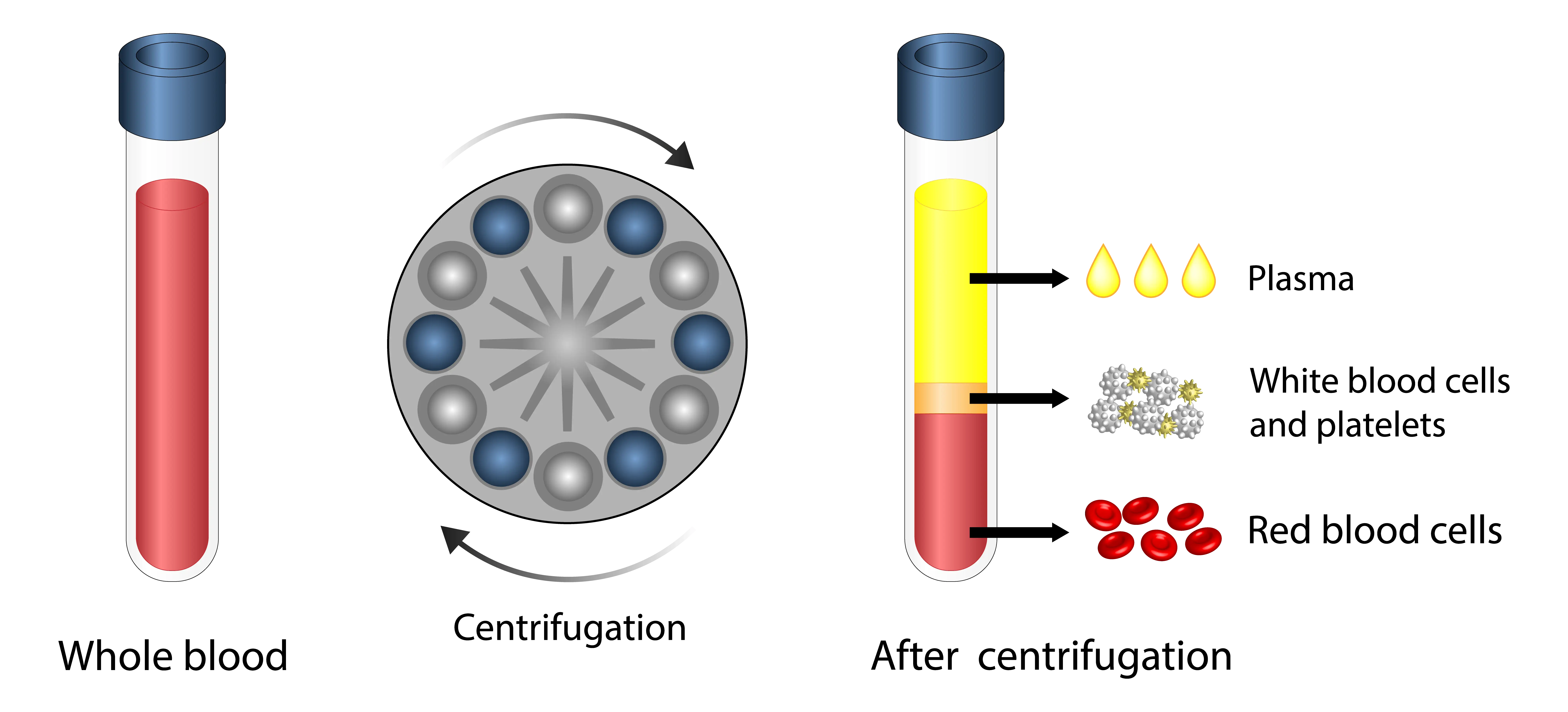 Graphic of Platelet-Rich Plasma (PRP)